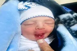 تولد یک نوزاد با دندان + عکس