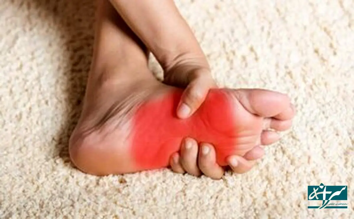 علت اصلی سوزش و داغی کف پا چیست؟