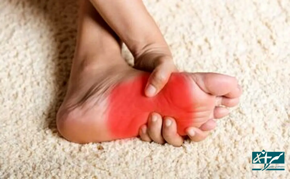 علت اصلی سوزش و داغی کف پا چیست؟