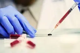 زلزله در پرورش اندام ایران: ۳ ورزشکار سرشناس، ۴ سال به جرم دوپینگ محروم شدند!