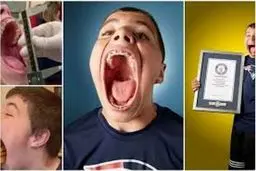 این پسر بزرگ ترین دهان دنیا را دارد + فیلم