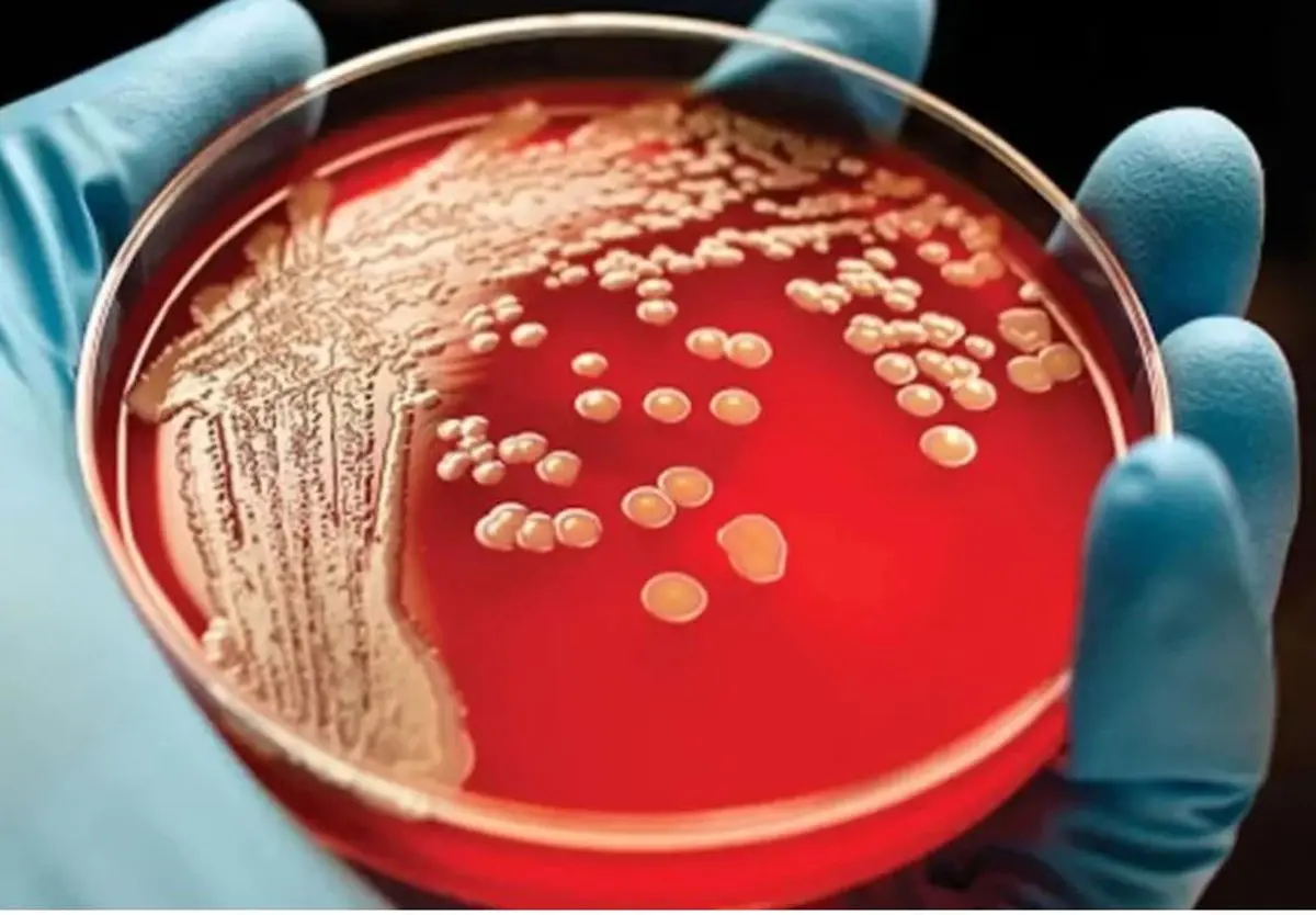 آمار عجیب از موارد ابتلا به سرطان