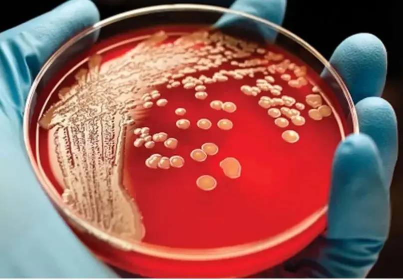 آمار عجیب از موارد ابتلا به سرطان